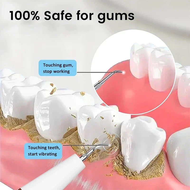 Teeth Flosser